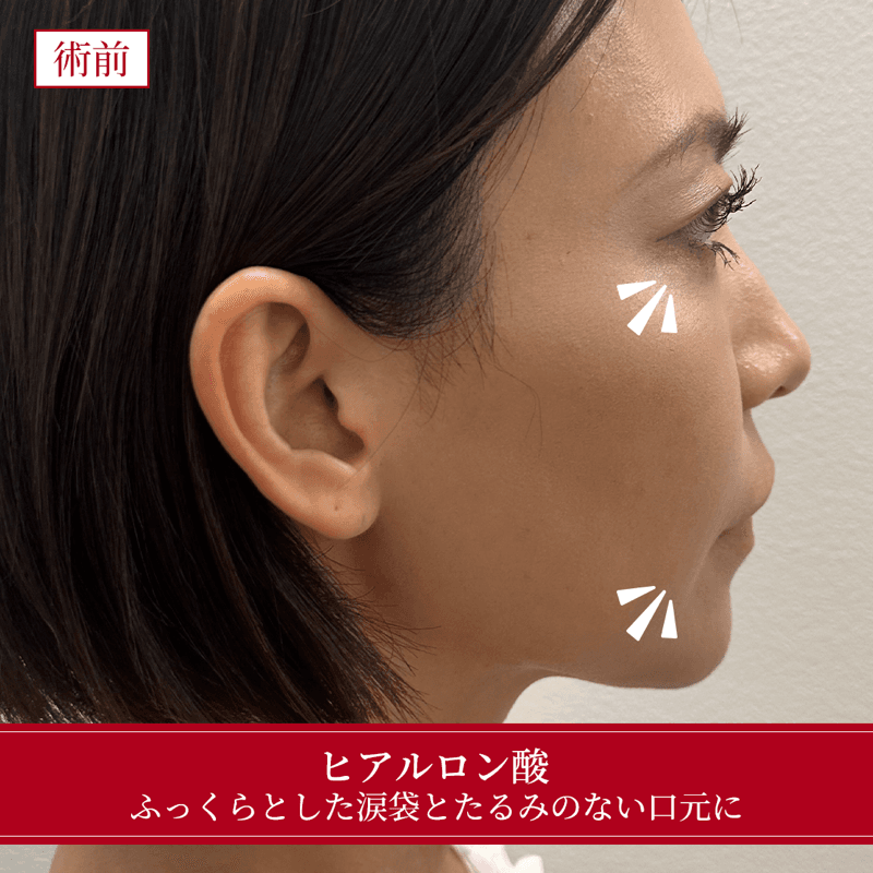 施術前