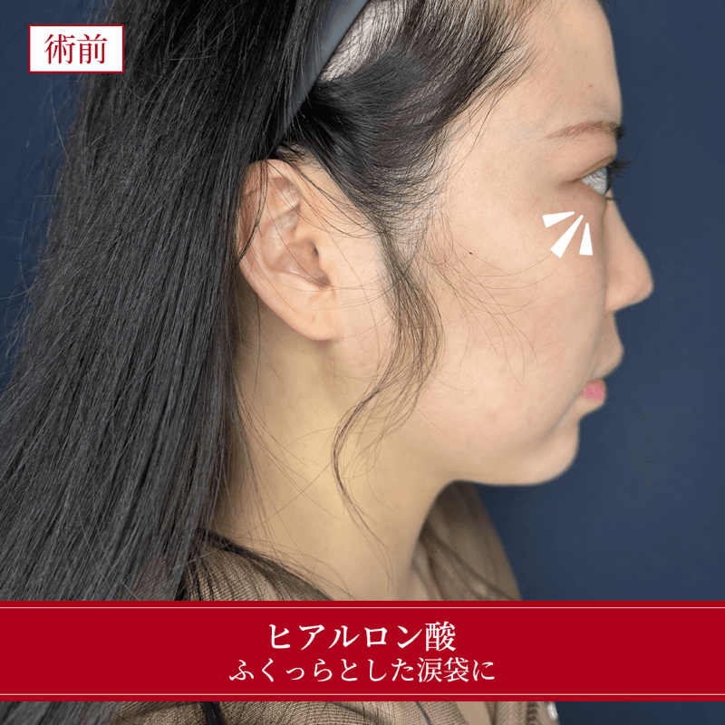 施術前