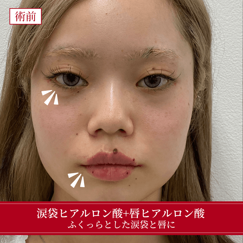 施術前