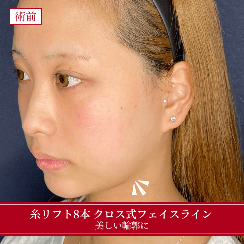 施術前